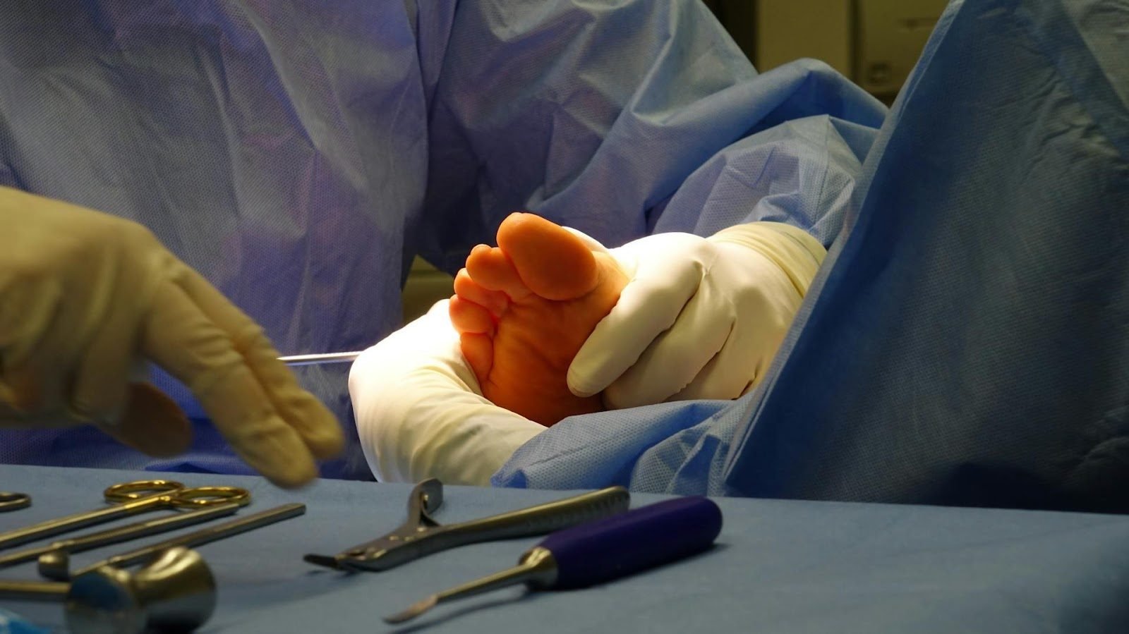 How Does Metal-Free Foot Surgery Change Recovery?